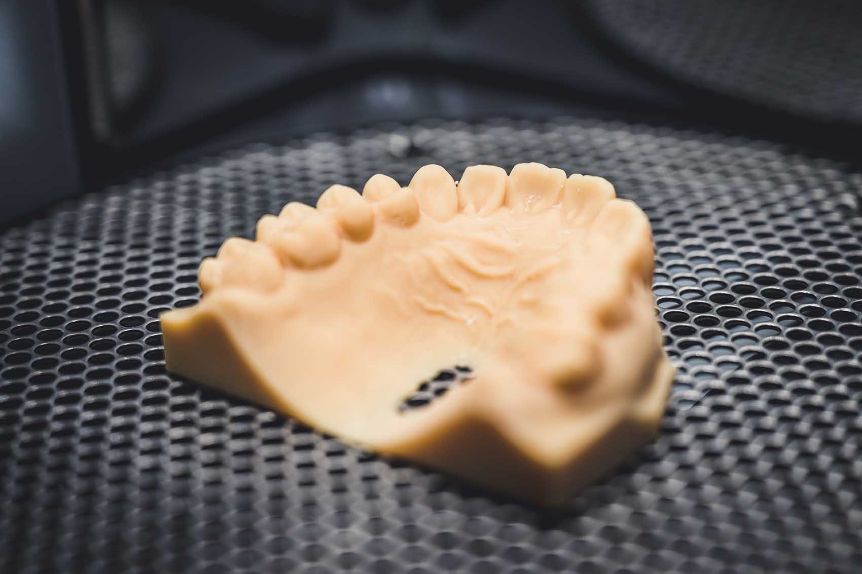 3D-Modell obere Zahnreihe, Alignertherapie